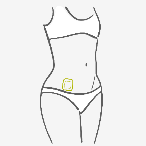 Contraceptive Patch Placement